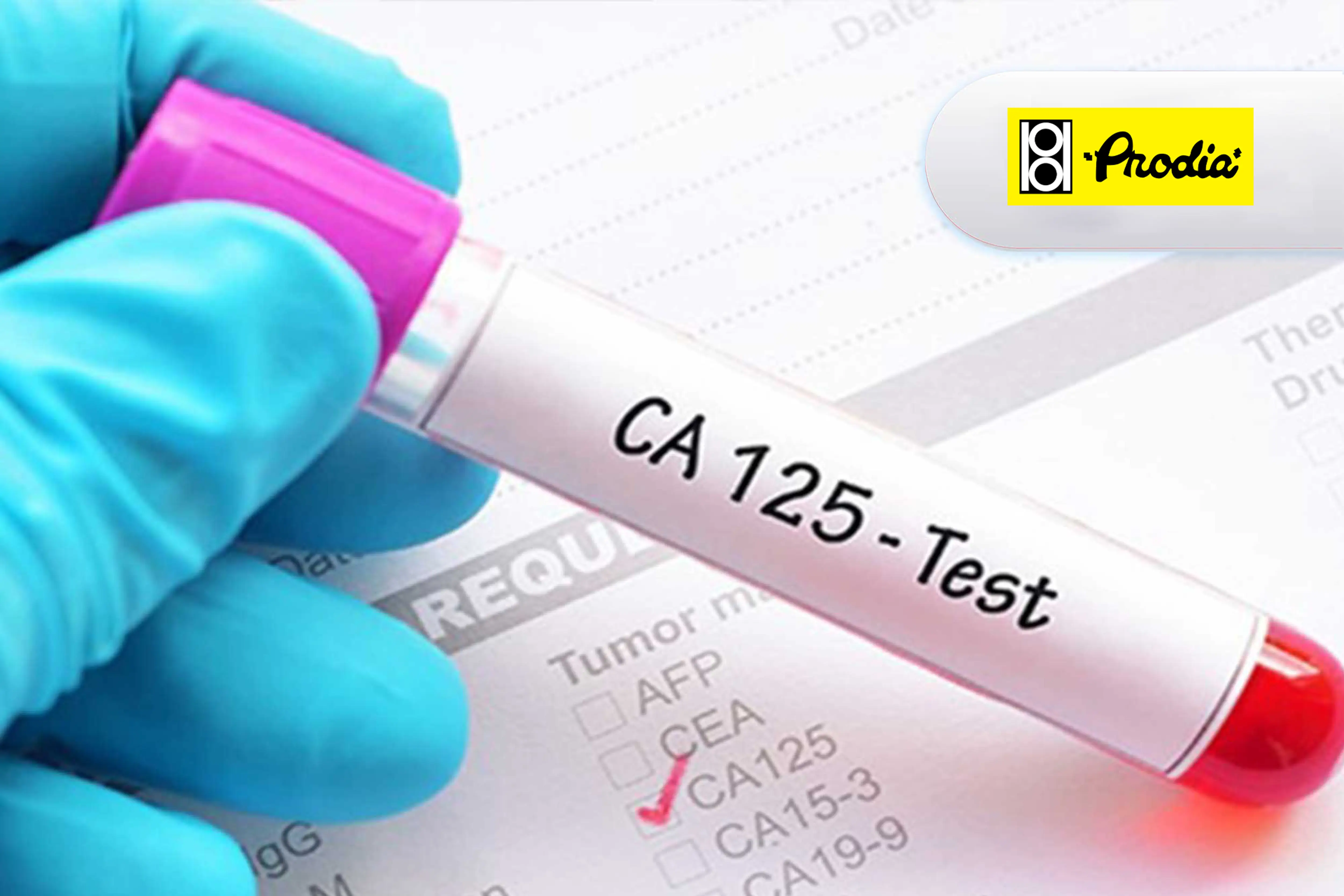 CA125